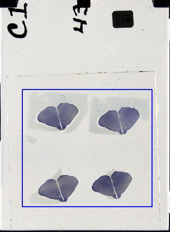 Media type: image; Special Collections 3298   shows specimen_part histological serial section;